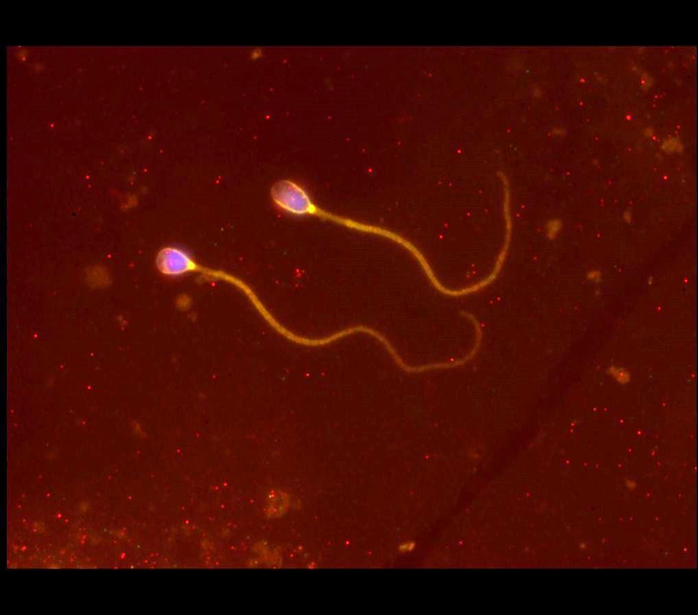 Spermatozoa, Vasin KS own work, Wikimedia commons